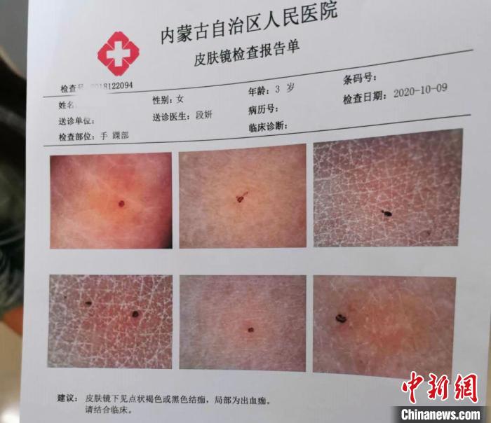 ͼΪ��ŮʿŮ���ļ�鱨�浥����Ůʿ��ͼ