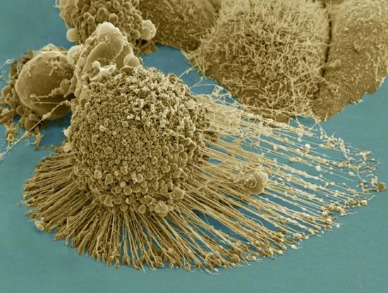 ������΢���£����ڵ�����һ������ϸ������Դ��National Institutes of Health ��NIH��