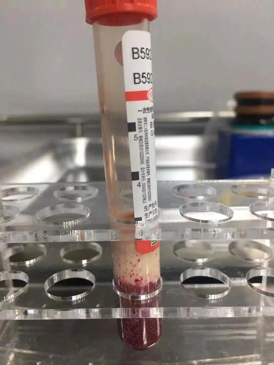 ��������ɫ��Ѫح����ɳ������΢�Ź��ں�