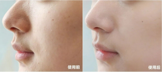 ��ʵ�ĶԱ�ͼ��������Ƥ�����۵���������ˮ��������ĳ�����Ȼ��